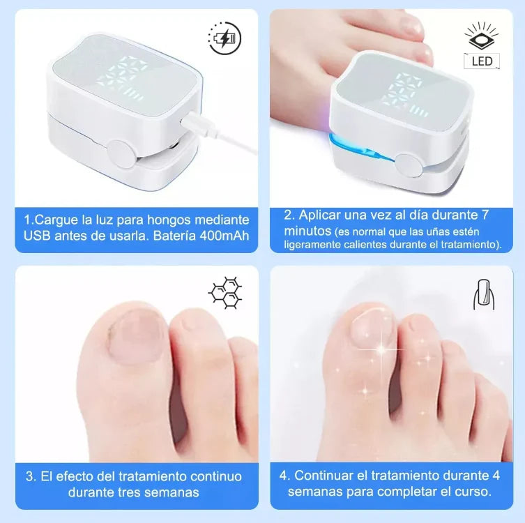 Dispositivo láser para hongos en las uñas Orthowl®