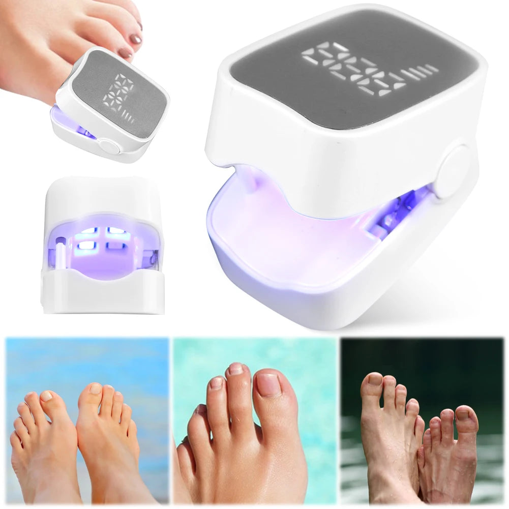 Dispositivo láser para hongos en las uñas Orthowl®